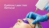 Eyebrow Laser Hair Removal